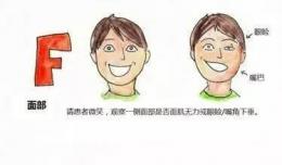 【世界卒中日】預(yù)防卒中，欽州市二醫(yī)院與您同行